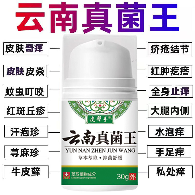 云南真菌王牛皮藓湿痒荨麻止痒外用顽固神经性皮肤真菌外用乳膏