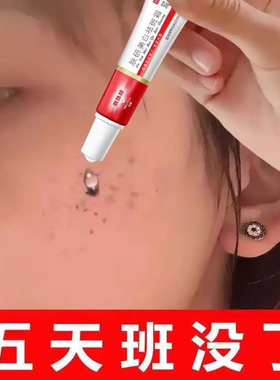 烟酰胺多年的老年斑强力去除黄褐斑一擦就掉正品去班霜官方旗舰店