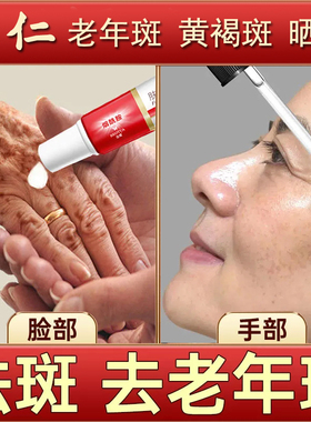 烟酰胺老年斑强力去除手脸部去除斑霜正品老年斑黄褐斑晒斑旗舰店