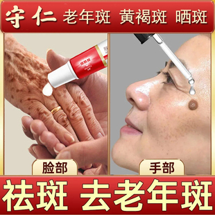 烟酰胺老年斑强力去除手脸部去除斑霜正品老年斑黄褐晒斑旗舰店