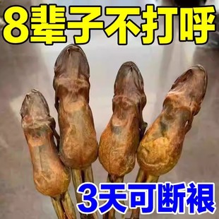 止鼾舌套防舌根后坠专用口腔矫正器物理防打呼噜止鼾器口舌训练器