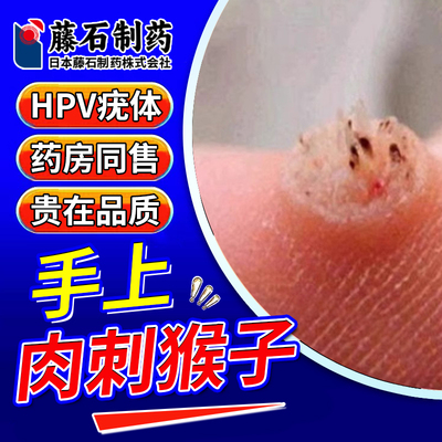 易复发试试它用完都能退！