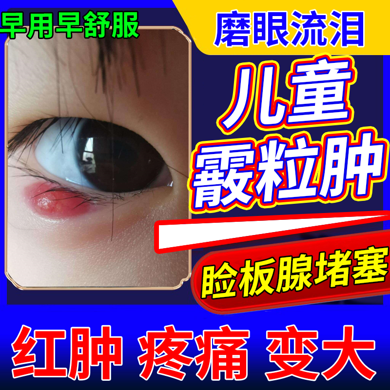 儿童霰粒肿热敷眼贴麦粒肿眼贴眼睛有异物感干涩疲劳肿痛冷敷贴pg
