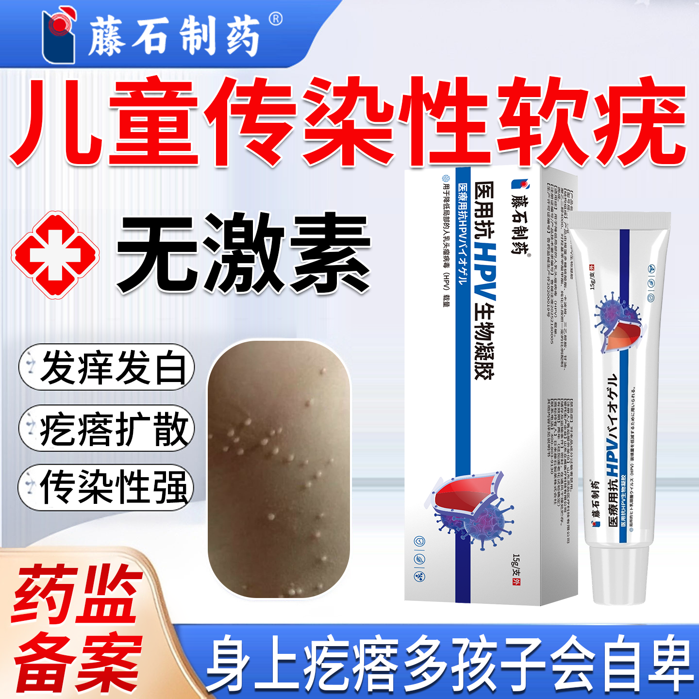 医用祛传染性软疣儿童抗hpv治疗病毒性水猴子肉粒疙瘩丝状凝胶P2