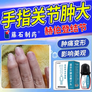 赫伯登结节专手指关节粗大变形肿大僵硬疼痛外用疙瘩药监备案PG