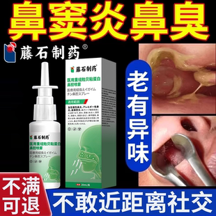 鼻窦炎鼻臭头痛真菌性鼻塞喷雾剂鼻涕倒流鼻子异味药监备案PG