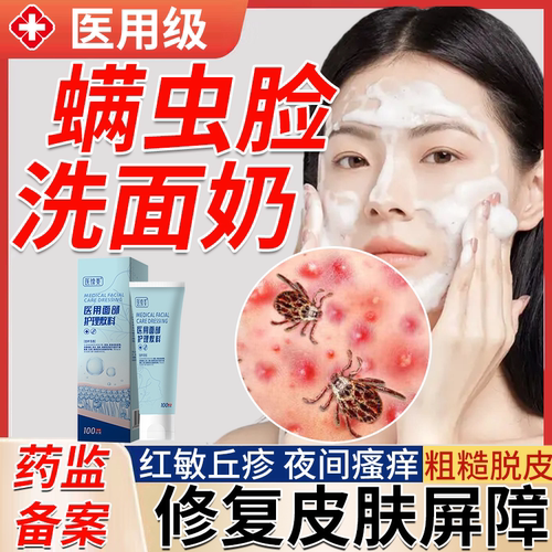 螨虫脸除螨医用洗面奶脸部螨虫毛囊面部清洁痤疮痘痘脂溢性皮炎PG