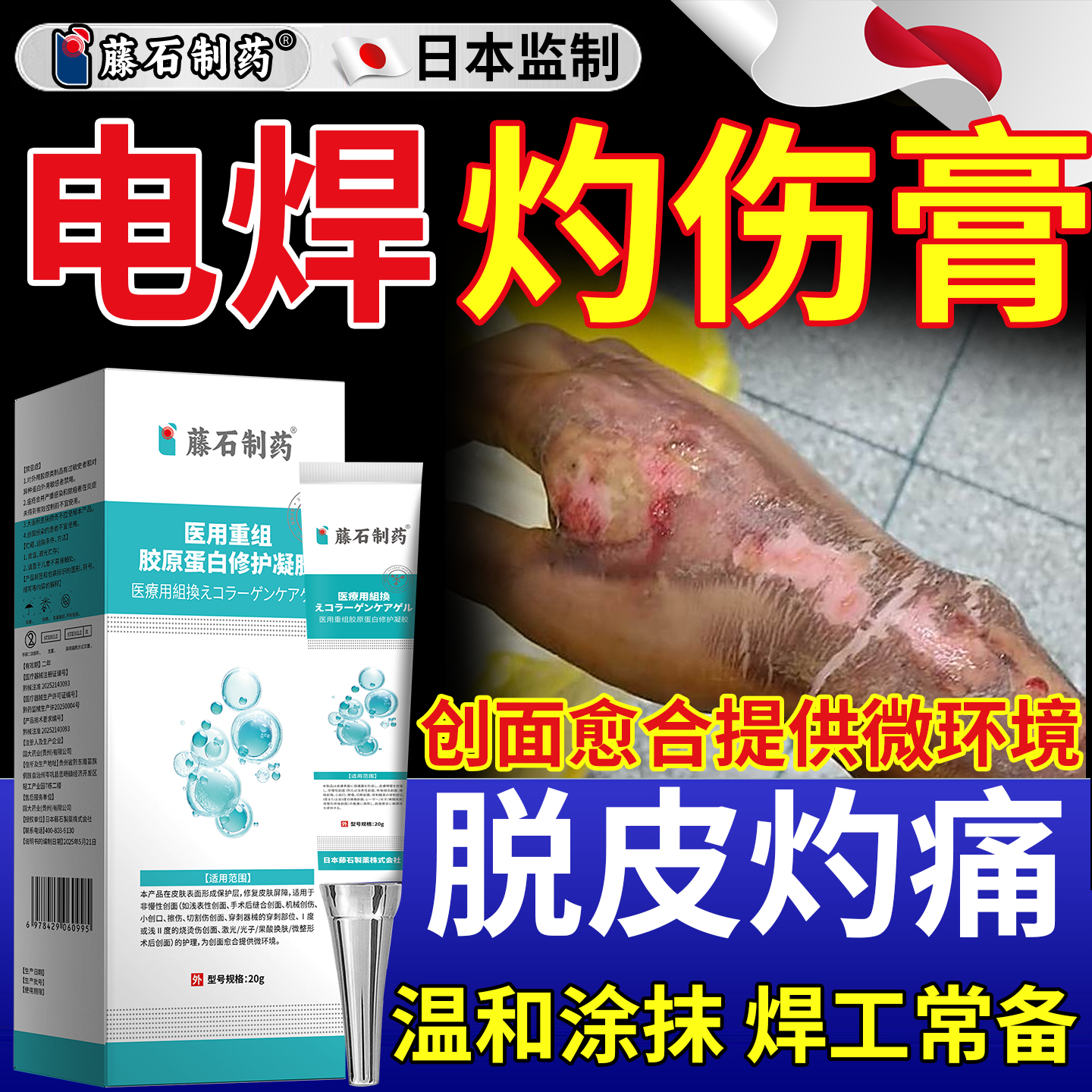 电焊灼伤电焊工脸灼伤发红干燥脱皮专用电弧烧伤皮肤烫伤膏PG