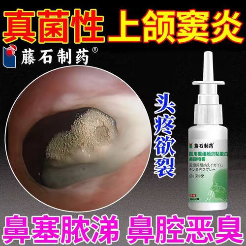 真菌性鼻窦炎排脓上颌窦炎药监备案头疼鼻涕倒流鼻塞通窍喷剂PG