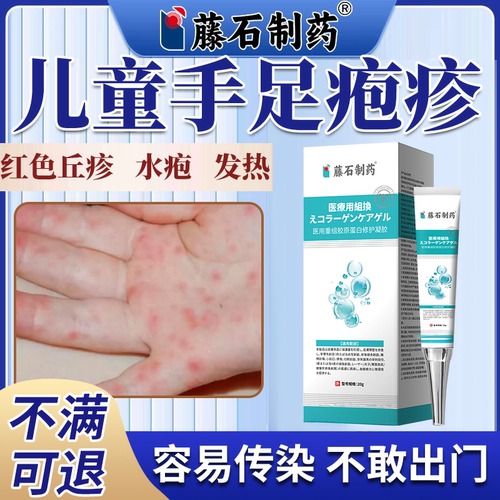 儿童手足口病疱疹药监备案膏凝胶疱疹性咽峡炎红点水疱传染疼痛PG