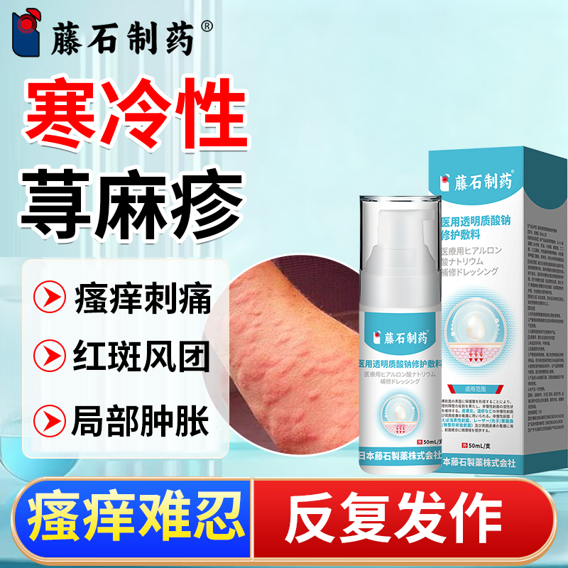 寒冷性荨麻疹膏寻麻疹过敏止痒断提高免疫力根慢性丘疹风团瘙痒PG