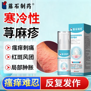 寒冷性荨麻疹膏寻麻疹过敏止痒断提高免疫力根慢性丘疹风团瘙痒PG