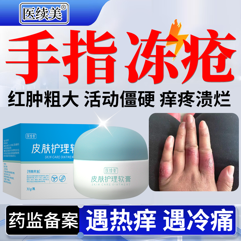 手指耳朵冻疮膏止痒冻伤膏冻伤冻裂红肿儿童消肿冻裂修复PG