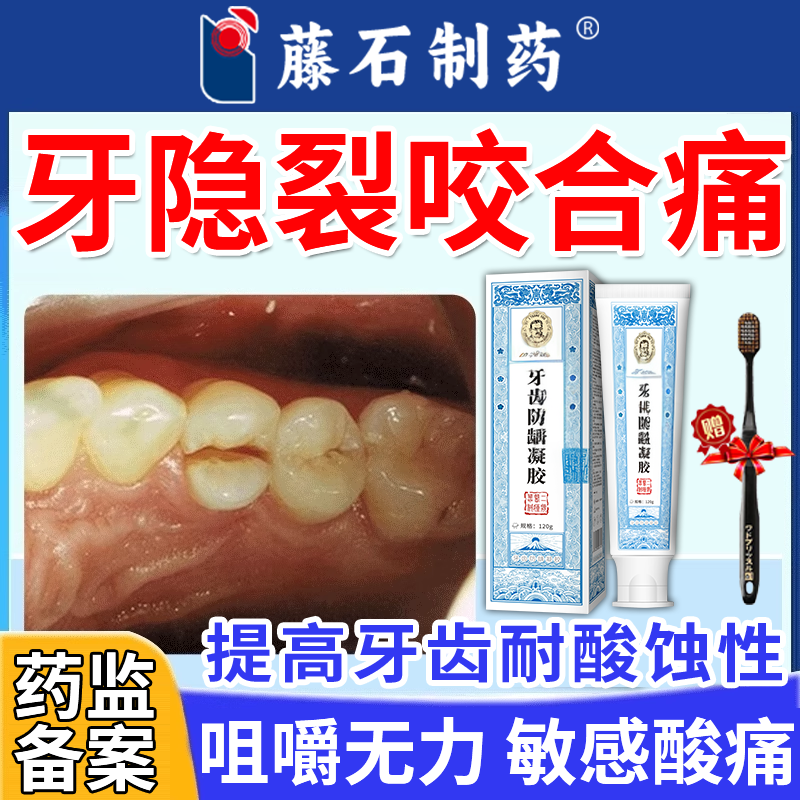 牙隐裂修牙裂牙釉质损伤复磨损脱矿发白咬合痛无力敏感酸痛膏N6