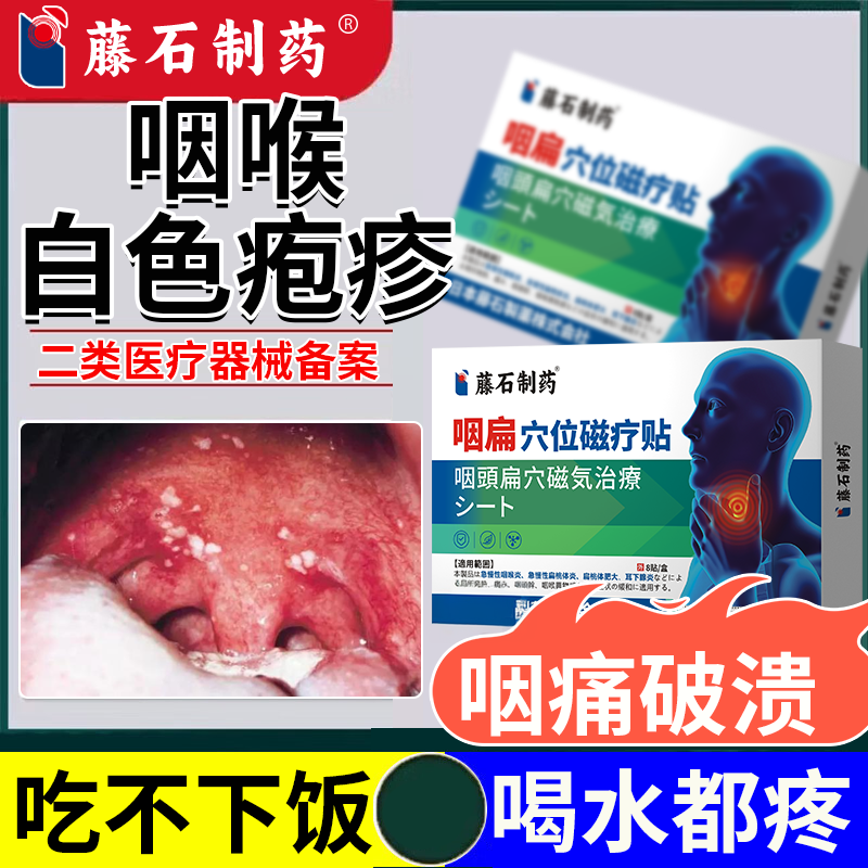 疱疹性咽峡炎膏贴慢性咽炎除根口腔疱疹咳嗽咽喉疼痛药监备案PG