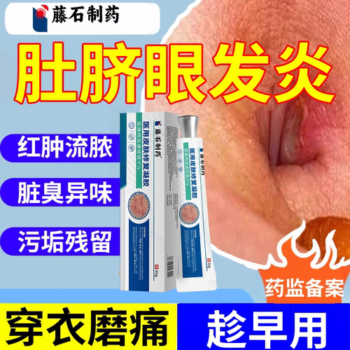 肚脐眼发炎流脓水出水发臭异味清除污垢清洁红肿瘙痒药监备案PG