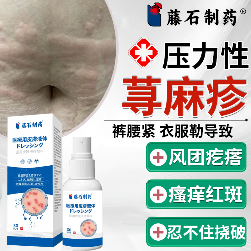 藤石制药荨麻疹压力性寻麻疹过敏止痒喷雾风团水肿皮肤瘙痒喷剂PG