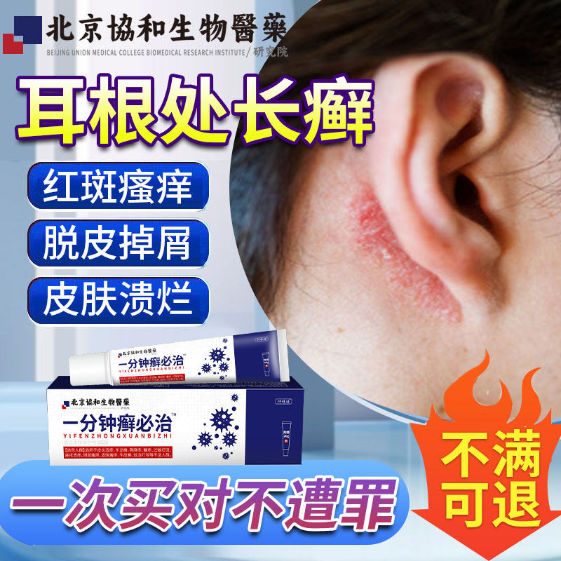 耳根处长癣烂耳朵耳后痒起皮耳朵外部起皮脱屑瘙痒结痂na
