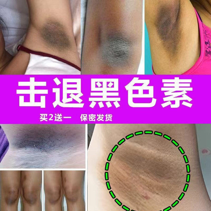 腋下美白去黑腋窝黑黑除黑变白去黑色素腋下胳肢窝去黑祛黑神器