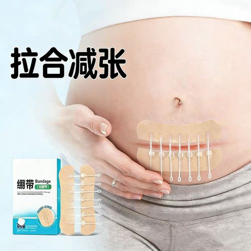 减张贴减张器绷带医用皮肤剖腹产术后儿童小伤口拉合胶布