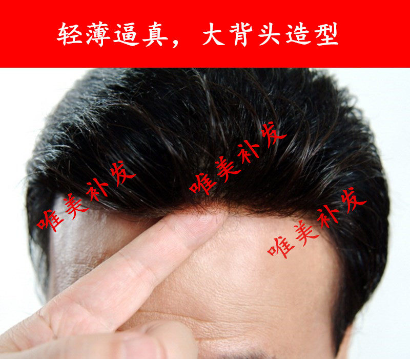 高档逼真仿生膜工艺隐形补发生物头皮超薄补发片真人发背头假发