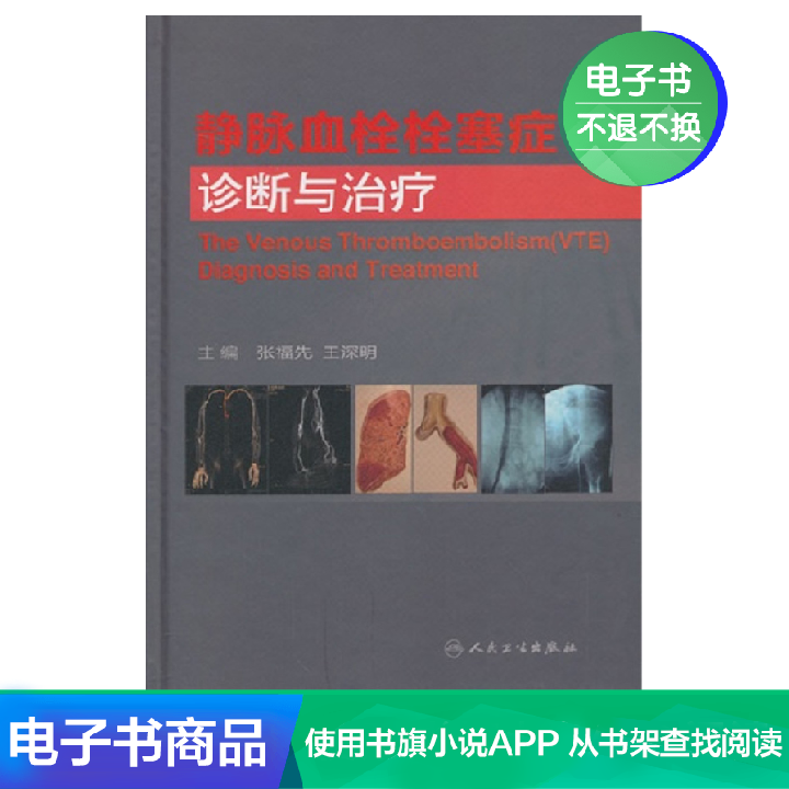 静脉血栓栓塞症诊断与治疗人民卫生出版社【电子书】