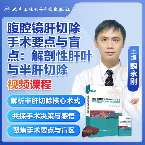 腹腔镜肝切除手术要点与盲点精解