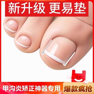 Nail correction device, specifically designed for ingrown to