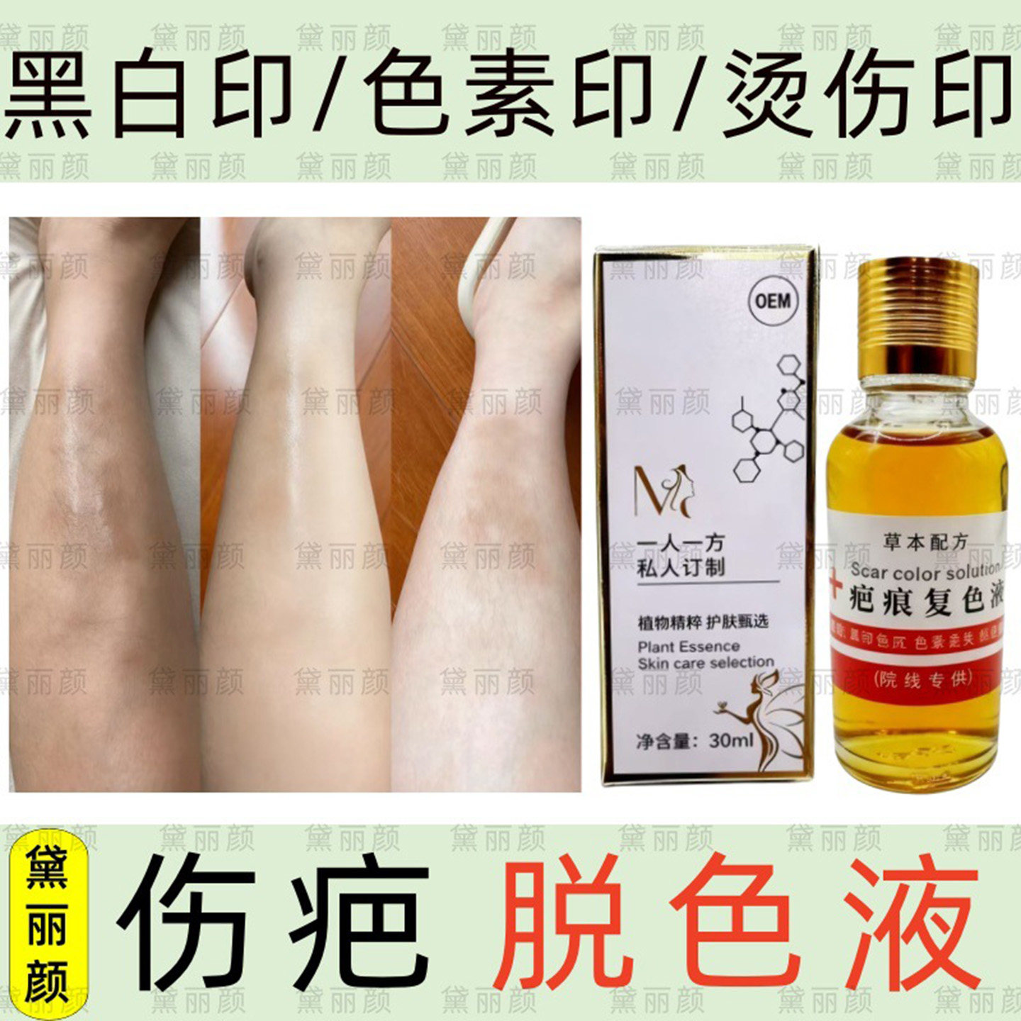 黛丽颜疤痕复色液淡化烫伤擦伤印