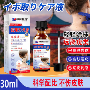 冈诚制药克疣液30ml去除尤类扁平尤丝状尤痦子尤瘊消除小肉粒肉刺