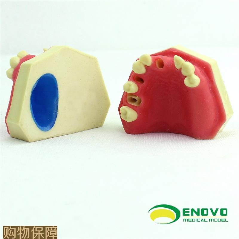 ENOVO颐诺口腔即刻种植练习操作模型上颌骨上颌窦牙列缺失种植体