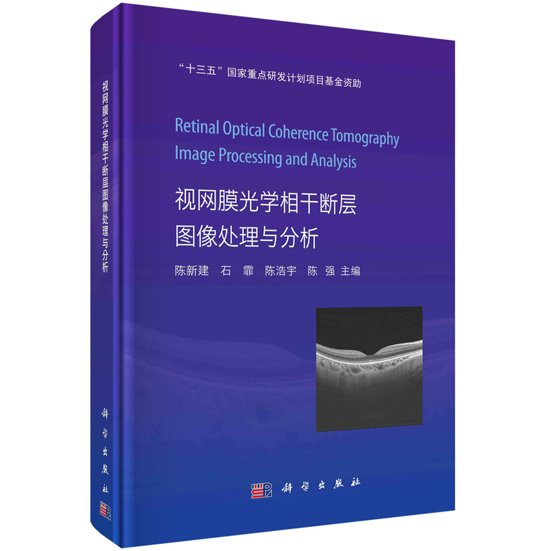 视网膜光学相干断层图像处理与分析陈新建等主编非损伤性非接触性的眼科影像学检查视网膜疾病诊断OCT成像视网膜病变眼科学科学社