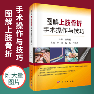 章莹 科学出版 夏虹 主编 社 尹庆水 图解上肢骨折手术操作与技巧