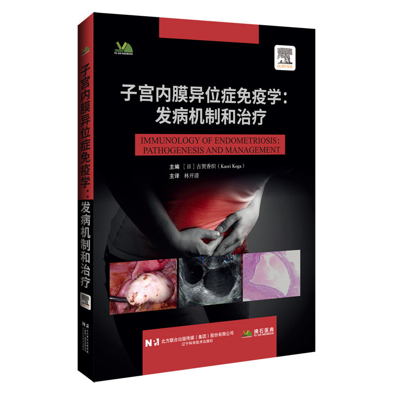 子宫内膜异位症免疫学:发病机制和治疗