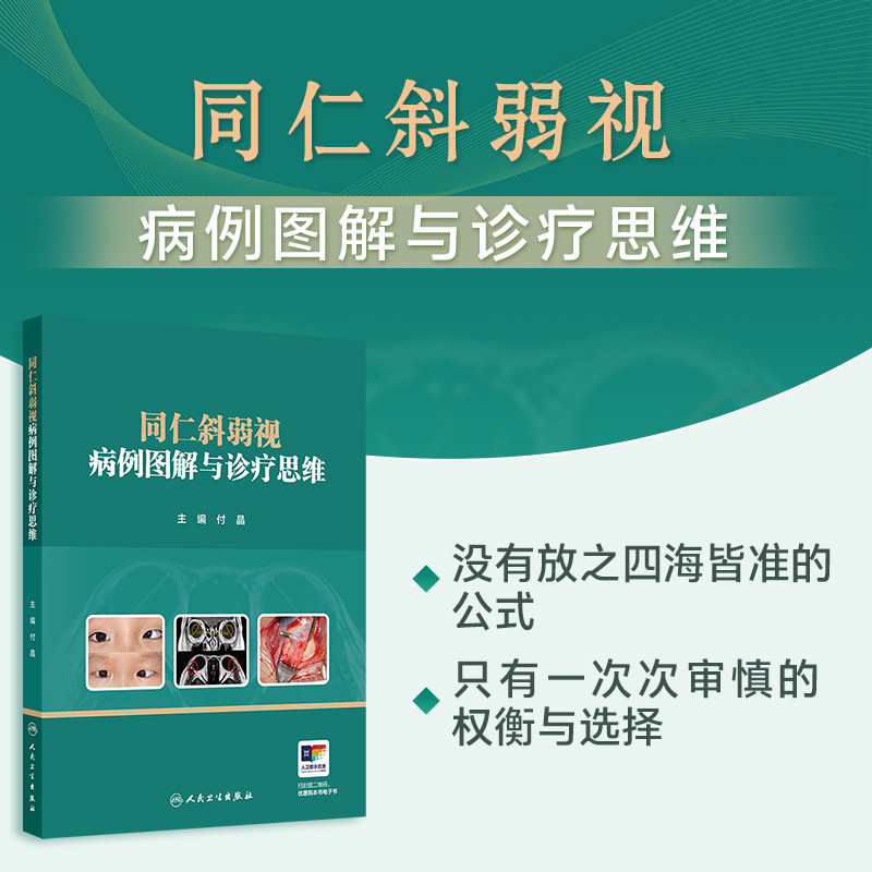 同仁斜弱视病例图解与诊疗思维