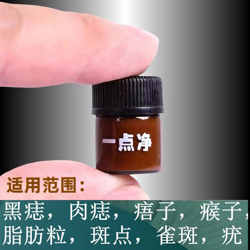 祛痣点痣膏无痕正品点斑黑点药肉痣疣瘊子痦子去除药水脖子上肉揪