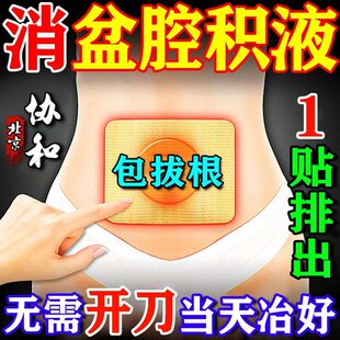 盆腔积液专用中药贴治疗慢性盆腔炎积液小腹疼妇科热敷包特效的药