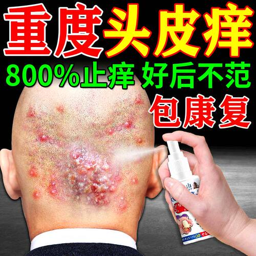 【毛囊炎效特膏药头皮部】喷剂