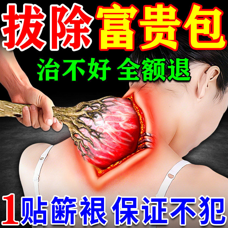 颈椎病富贵包消除贴正品专用特效膏药去除大椎穴淤堵疏通神器热敷