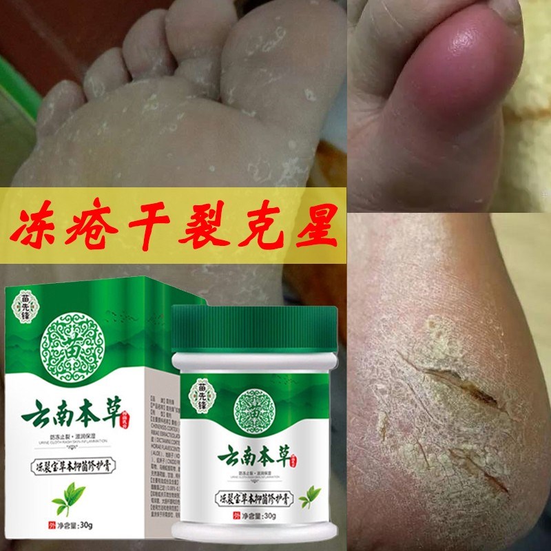 云南本草手足防冻裂宝脚部冻疮膏抑菌脱皮脚后跟皲裂膏皮肤保湿霜