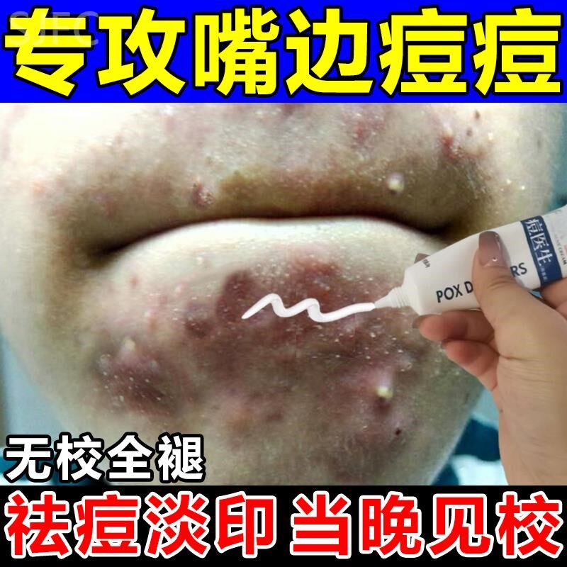 嘴边嘴角嘴巴周围下巴反复长痘痘调理熬夜上火脸上腮帮子出油长痘