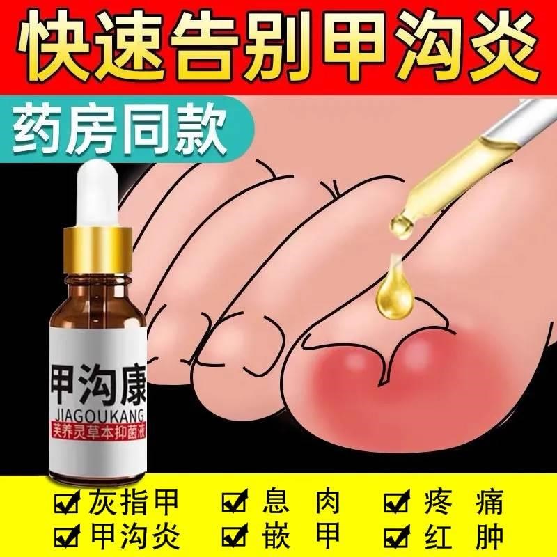 甲沟康趾甲沟脚指甲长肉里面非剪专用到往勾甲炎药入肉修复神器
