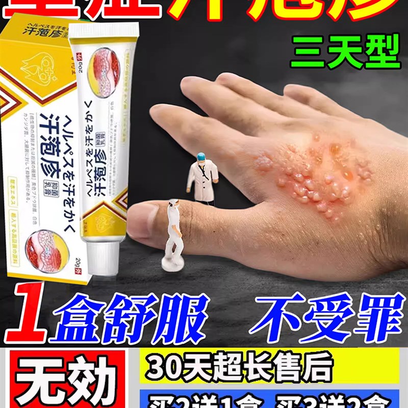 汗泡疱珍药手上起小水泡膏止痒汉汗状包疹专用真菌感染手气痒软膏