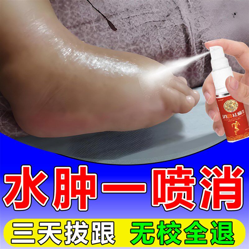 消肿去水肿专用i治老i人脚肿利尿排水肿去下肢浮肿特i效贴喷剂