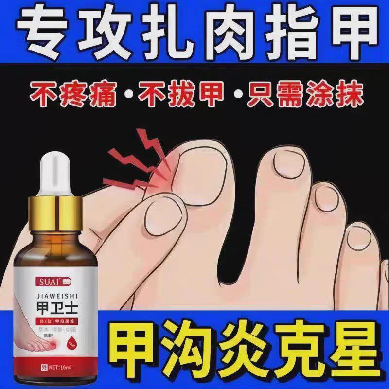 【严重甲沟炎专用】去肉芽脚趾甲往肉里长嵌甲红肿疼痛化脓抑菌液