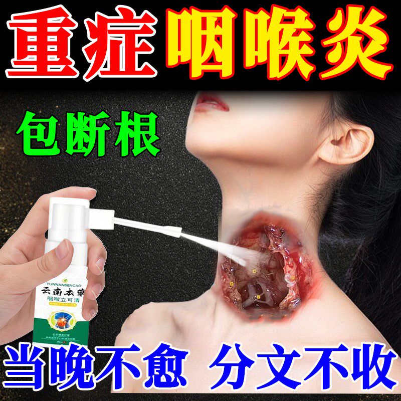 咽喉炎慢性咽炎除根喷雾剂药治喉咙滤泡增生润烟喉糖异物感贴专用