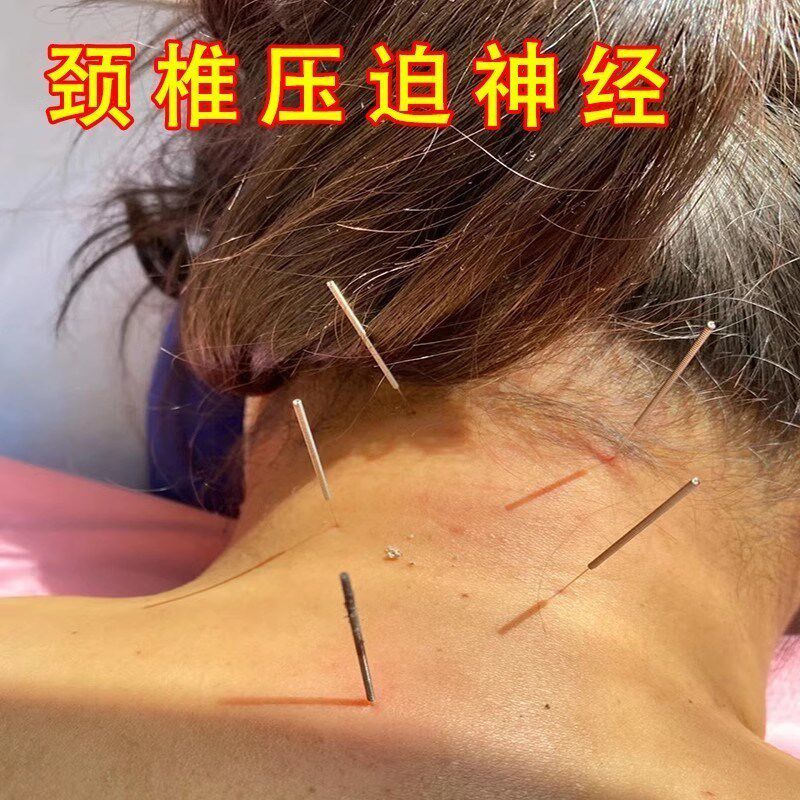 颈压迫椎神经缓头晕解头脖子疼僵硬手颈麻椎特校贴膏