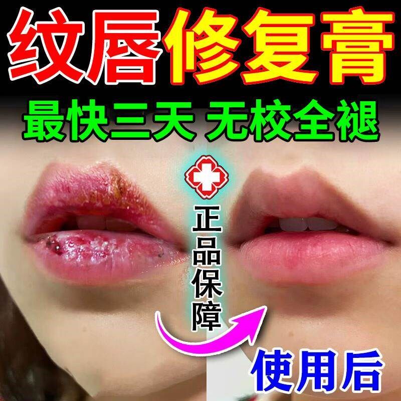纹唇后专用修复液精华膏蜜亮唇锁色漂唇后的亮唇素结痂消肿纹绣剂