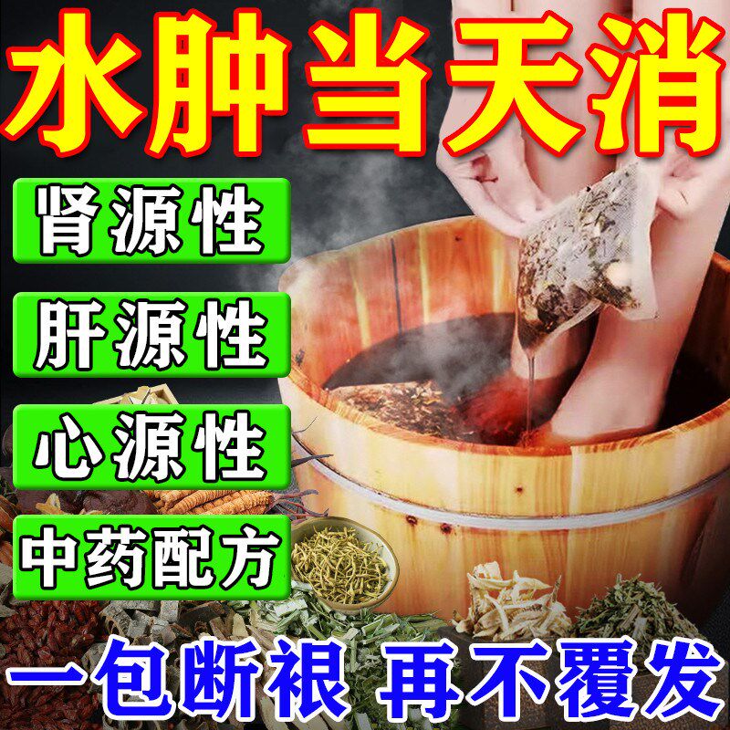 消肿去水肿专用老人脚肿消肿的药利尿排水肿治小腿下肢部浮肿神器