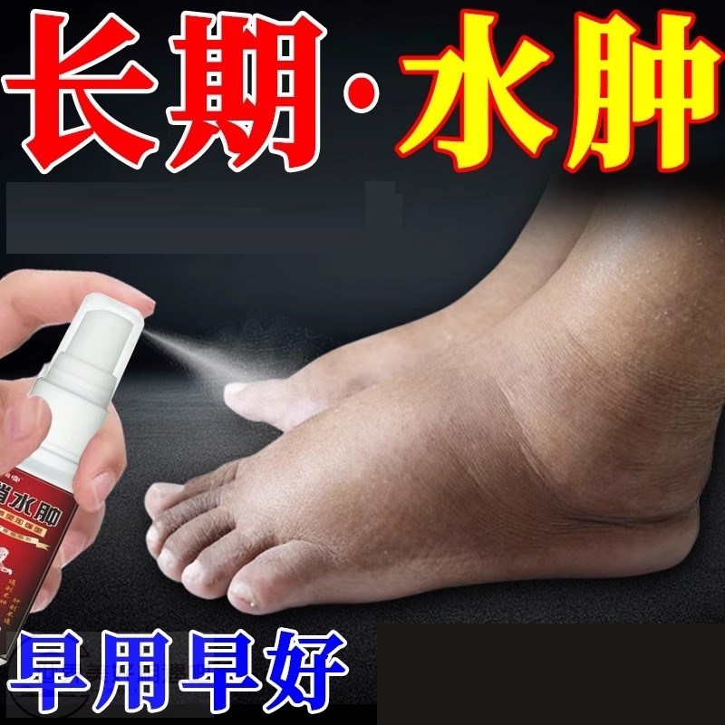 消肿去水肿专i用i治老i人脚肿利尿排水肿去下肢浮肿特i效贴喷剂